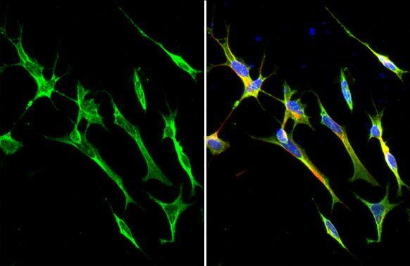SARM1 antibody [HL1070] detects SARM1 protein by immunofluorescent analysis.Sample: SH-SY-5Y cells were fixed in 4% paraformaldehyde at RT for 15 min.Green: SARM1 stained by SARM1 antibody [HL1070] (NBP3-13710) diluted at 1:500.Red: alpha Tubulin, a cytoskeleton marker, stained by alpha Tubulin antibody [GT114]  diluted at 1:1000.Blue: Fluoroshield with DAPI . 