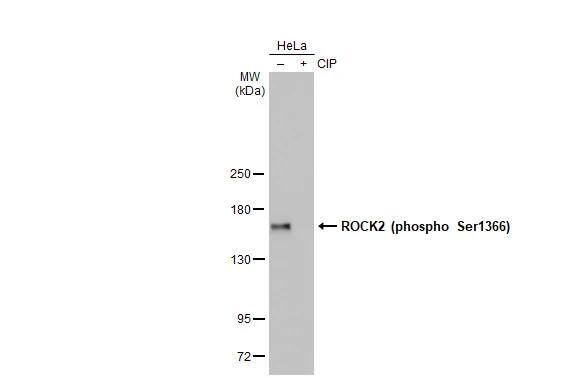 Untreated (-) and treated (+) HeLa whole cell extracts (30 ug) were separated by 5% SDS-PAGE, and the membrane was blotted with ROCK2 (phospho Ser1366) antibody [HL1071] (NBP3-13711) diluted at 1:1000. The HRP-conjugated anti-rabbit IgG antibody  was used to detect the primary antibody. (CIP: Calf-intestinal alkaline phosphatase) 