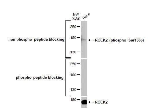 Whole cell extract (30 ug) was separated by 5% SDS-PAGE, and the membrane was blotted with primary antibodies diluted at 1:1000. The HRP-conjugated anti-rabbit IgG antibody was used to detect the primary antibody, and the signal was developed with Trident ECL plus-Enhanced.Upper : ROCK2 (phospho Ser1366) antibody [HL1071] (NBP3-13711)Lower : ROCK2 antibody  