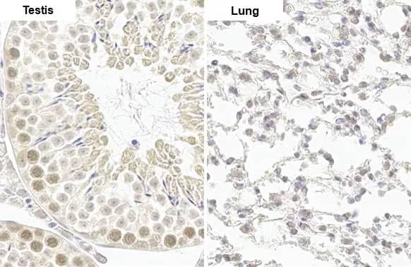 Immunohistochemistry-Paraffin: CLOCK Antibody (HL1099) [NBP3-13718] - CLOCK antibody [HL1099] detects CLOCK protein by immunohistochemical analysis.Sample: Paraffin-embedded mouse tissues.CLOCK stained by CLOCK antibody [HL1099] (NBP3-13718) diluted at 1:100.Antigen Retrieval: Citrate buffer, pH 6.0, 15 min