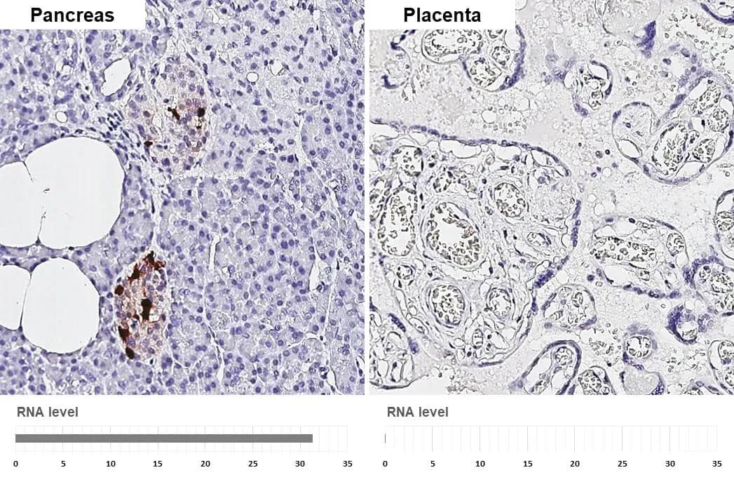 Somatostatin antibody [HL1101] detects Somatostatin protein by immunohistochemical analysis.Sample: Paraffin-embedded human tissues.Somatostatin stained by Somatostatin antibody [HL1101] (NBP3-13719) diluted at 1:2000.Antigen Retrieval: Citrate buffer, pH 6.0, 15 min 
