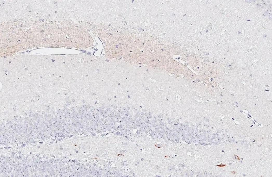 Somatostatin antibody [HL1101] detects Somatostatin protein by immunohistochemical analysis.Sample: Paraffin-embedded mouse hippocampus.Somatostatin stained by Somatostatin antibody [HL1101] (NBP3-13719) diluted at 1:2000.Antigen Retrieval: Citrate buffer, pH 6.0, 15 min 