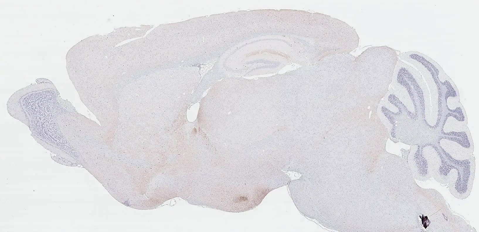 Somatostatin antibody [HL1101] detects Somatostatin protein by immunohistochemical analysis.Sample: Paraffin-embedded mouse brain.Somatostatin stained by Somatostatin antibody [HL1101] (NBP3-13719) diluted at 1:2000.Antigen Retrieval: Citrate buffer, pH 6.0, 15 min 