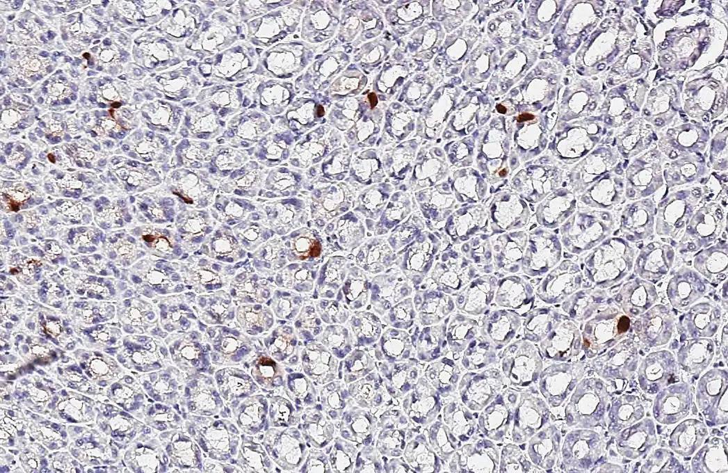 Somatostatin antibody [HL1101] detects Somatostatin protein by immunohistochemical analysis.Sample: Paraffin-embedded rat stomach.Somatostatin stained by Somatostatin antibody [HL1101] (NBP3-13719) diluted at 1:2000.Antigen Retrieval: Citrate buffer, pH 6.0, 15 min 
