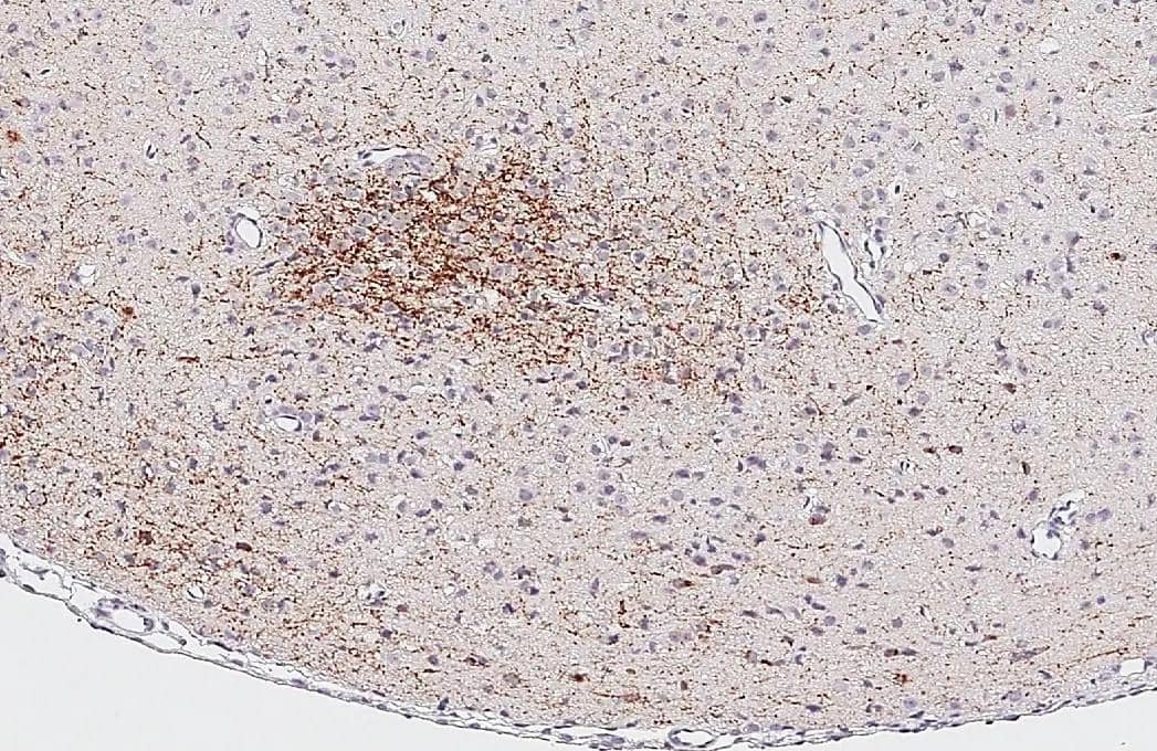Somatostatin antibody [HL1101] detects Somatostatin protein by immunohistochemical analysis.Sample: Paraffin-embedded mouse hypothalamus.Somatostatin stained by Somatostatin antibody [HL1101] (NBP3-13719) diluted at 1:2000.Antigen Retrieval: Citrate buffer, pH 6.0, 15 min 