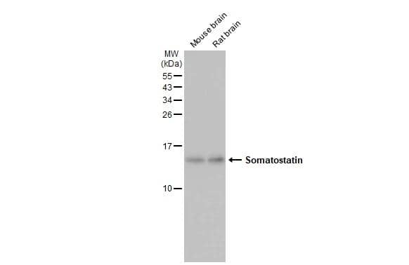 Various tissue extracts (50 ug) were separated by 15% SDS-PAGE, and the membrane was blotted with Somatostatin antibody [HL1101] (NBP3-13719) diluted at 1:5000. The HRP-conjugated anti-rabbit IgG antibody  was used to detect the primary antibody. 