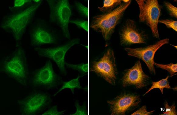 Immunocytochemistry/ Immunofluorescence: Acetylcholinesterase/ACHE Antibody (HL1102) [NBP3-13720] - Acetylcholinesterase/ACHE antibody [HL1102] detects Acetylcholinesterase/ACHE protein at endoplasmic reticulum by immunofluorescent analysis.Sample: HeLa cells were fixed in 4% paraformaldehyde at RT for 15 min.Green: Acetylcholinesterase/ACHE stained by Acetylcholinesterase/ACHE antibody [HL1102] (NBP3-13720) diluted at 1:500.Red: alpha Tubulin, a cytoskeleton marker, stained by alpha Tubulin antibody [GT114]  diluted at 1:1000.Blue: Fluoroshield with DAPI .Scale bar= 10um.