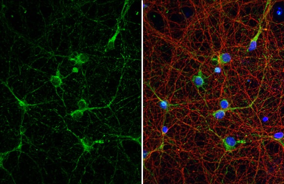 Immunocytochemistry/ Immunofluorescence: Acetylcholinesterase/ACHE Antibody (HL1102) [NBP3-13720] - Acetylcholinesterase/ACHE antibody [HL1102] detects Acetylcholinesterase/ACHE protein at dendrite by immunofluorescent analysis.Sample: DIV9 rat E18 primary cortical neuron and glia cells were fixed in 4% paraformaldehyde at RT for 15 min.Green: Acetylcholinesterase/ACHE stained by Acetylcholinesterase/ACHE antibody [HL1102] (NBP3-13720) diluted at 1:250.Red: Tau, an axon marker, stained by Tau antibody [GT287]  diluted at 1:500.Blue: Fluoroshield with DAPI .