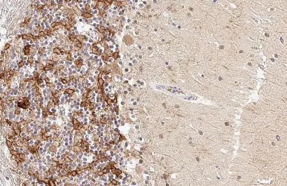 Immunohistochemistry-Paraffin: Acetylcholinesterase/ACHE Antibody (HL1102) [NBP3-13720] - Acetylcholinesterase/ACHE antibody [HL1102] detects Acetylcholinesterase/ACHE protein at cell membrane and cytoplasm by immunohistochemical analysis.Sample: Paraffin-embedded cat brain.Acetylcholinesterase/ACHE stained by Acetylcholinesterase/ACHE antibody [HL1102] (NBP3-13720) diluted at 1:100.Antigen Retrieval: Citrate buffer, pH 6.0, 15 min