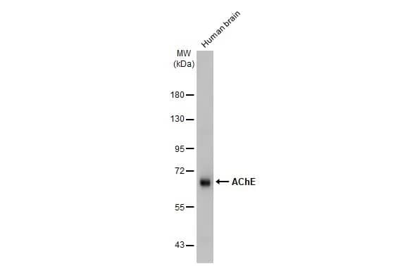 Western Blot: Acetylcholinesterase/ACHE Antibody (HL1102) [NBP3-13720] - Human tissue extract (30 ug) was separated by 7.5% SDS-PAGE, and the membrane was blotted with Acetylcholinesterase/ACHE antibody [HL1102] (NBP3-13720) diluted at 1:500. The HRP-conjugated anti-rabbit IgG antibody  was used to detect the primary antibody, and the signal was developed with Trident ECL plus-Enhanced.