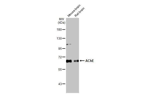 Various tissue extracts (50 ug) were separated by 7.5% SDS-PAGE, and the membrane was blotted with AChE antibody [HL1102] (NBP3-13720) diluted at 1:1000. The HRP-conjugated anti-rabbit IgG antibody  was used to detect the primary antibody. 