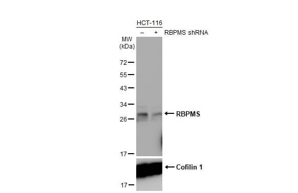 <b>Genetic Strategies Validation. </b>Western Blot: RBPMS Antibody (HL1105) [NBP3-13722] - Non-transfected (–) and transfected (+) HCT-116 whole cell extract (60 ug) were separated by 12% SDS-PAGE, and the membrane was blotted with RBPMS antibody [HL1105]  diluted at 1:10000. The HRP-conjugated anti-rabbit IgG antibody  was used to detect the primary antibody.