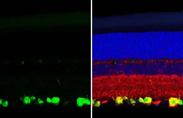 Immunohistochemistry-Paraffin: RBPMS Antibody (HL1105) [NBP3-13722] - RBPMS antibody [HL1105] detects RBPMS protein at cytoplasm and nucleus by immunohistochemical analysis.Sample: Paraffin-embedded rat eye.Green: RBPMS stained by RBPMS antibody [HL1105] (NBP3-13722) diluted at 1:250.Red: beta Tubulin 3/ Tuj1, a neural marker, stained by beta Tubulin 3/ Tuj1 antibody [GT11710]  diluted at 1:500.Blue: Fluoroshield with DAPI .Antigen Retrieval: Citrate buffer, pH 6.0, 15 min