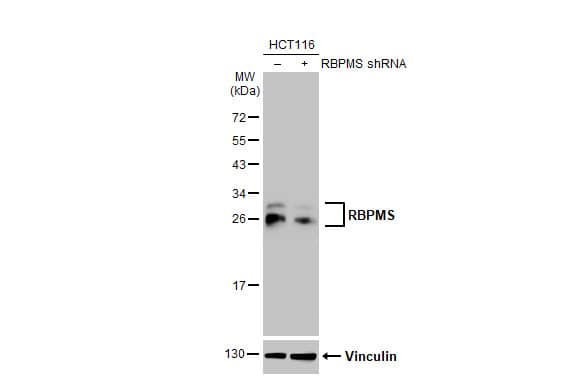 <b>Genetic Strategies Validation. </b>Non-transfected (-) and transfected (+) HCT116 whole cell extracts (60 ug) were separated by 12% SDS-PAGE, and the membrane was blotted with RBPMS antibody [HL1105] (NBP3-13722) diluted at 1:10000. The HRP-conjugated anti-rabbit IgG antibody  was used to detect the primary antibody, and the signal was developed with Trident ECL plus-Enhanced. 