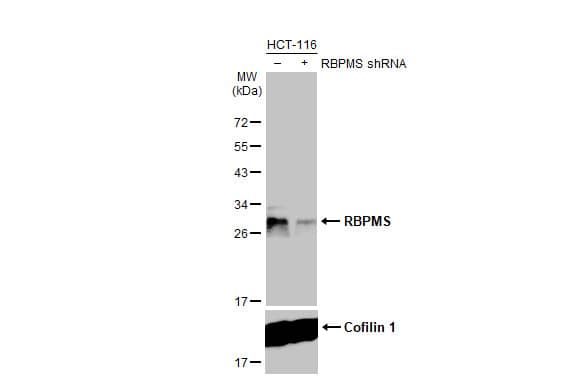 <b>Genetic Strategies Validation. </b>Western Blot: RBPMS Antibody (HL1106) [NBP3-13723] - Non-transfected (–) and transfected (+) HCT-116 whole cell extract (60 ug) were separated by 12% SDS-PAGE, and the membrane was blotted with RBPMS antibody [HL1106]  diluted at 1:5000. The HRP-conjugated anti-rabbit IgG antibody  was used to detect the primary antibody.
