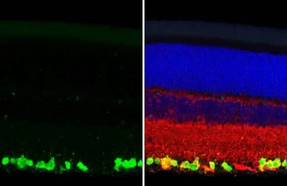 Immunohistochemistry-Paraffin: RBPMS Antibody (HL1106) [NBP3-13723] - RBPMS antibody [HL1106] detects RBPMS protein at cytoplasm and nucleus by immunohistochemical analysis.Sample: Paraffin-embedded rat eye.Green: RBPMS stained by RBPMS antibody [HL1106] (NBP3-13723) diluted at 1:250.Red: beta Tubulin 3/ Tuj1, a neural marker, stained by beta Tubulin 3/ Tuj1 antibody [GT11710]  diluted at 1:500.Blue: Fluoroshield with DAPI .Antigen Retrieval: Citrate buffer, pH 6.0, 15 min