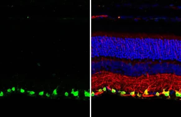 Immunohistochemistry-Paraffin: RBPMS Antibody (HL1106) [NBP3-13723] - RBPMS antibody [HL1106] detects RBPMS protein at cytoplasm and nucleus by immunohistochemical analysis.Sample: Paraffin-embedded mouse eye.Green: RBPMS stained by RBPMS antibody [HL1106] (NBP3-13723) diluted at 1:250.Red: beta Tubulin 3/ Tuj1, a neural marker, stained by beta Tubulin 3/ Tuj1 antibody [GT11710]  diluted at 1:500.Blue: Fluoroshield with DAPI .Antigen Retrieval: Citrate buffer, pH 6.0, 15 min