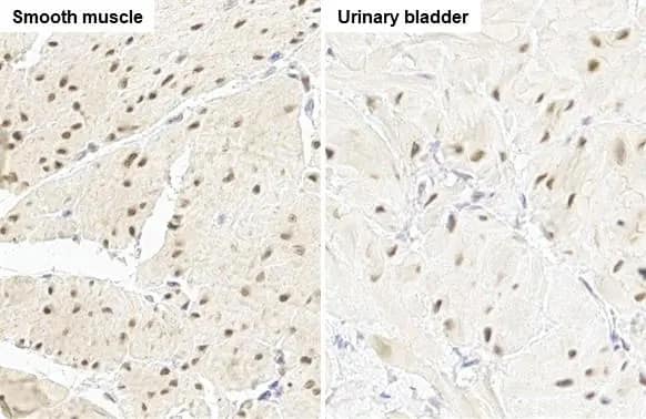 Immunohistochemistry-Paraffin: RBPMS Antibody (HL1106) [NBP3-13723] - RBPMS antibody [HL1106] detects RBPMS protein by immunohistochemical analysis.Sample: Paraffin-embedded mouse tissues.RBPMS stained by RBPMS antibody [HL1106] (NBP3-13723) diluted at 1:100.Antigen Retrieval: Citrate buffer, pH 6.0, 15 min