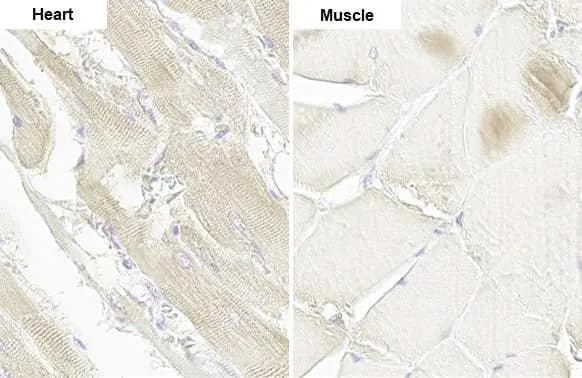 Immunohistochemistry-Paraffin: DDR2 Antibody (HL1107) [NBP3-13724] - DDR2 antibody [HL1107] detects DDR2 protein by immunohistochemical analysis.Sample: Paraffin-embedded rat tissues.DDR2 stained by DDR2 antibody [HL1107] (NBP3-13724) diluted at 1:100.Antigen Retrieval: Citrate buffer, pH 6.0, 15 min