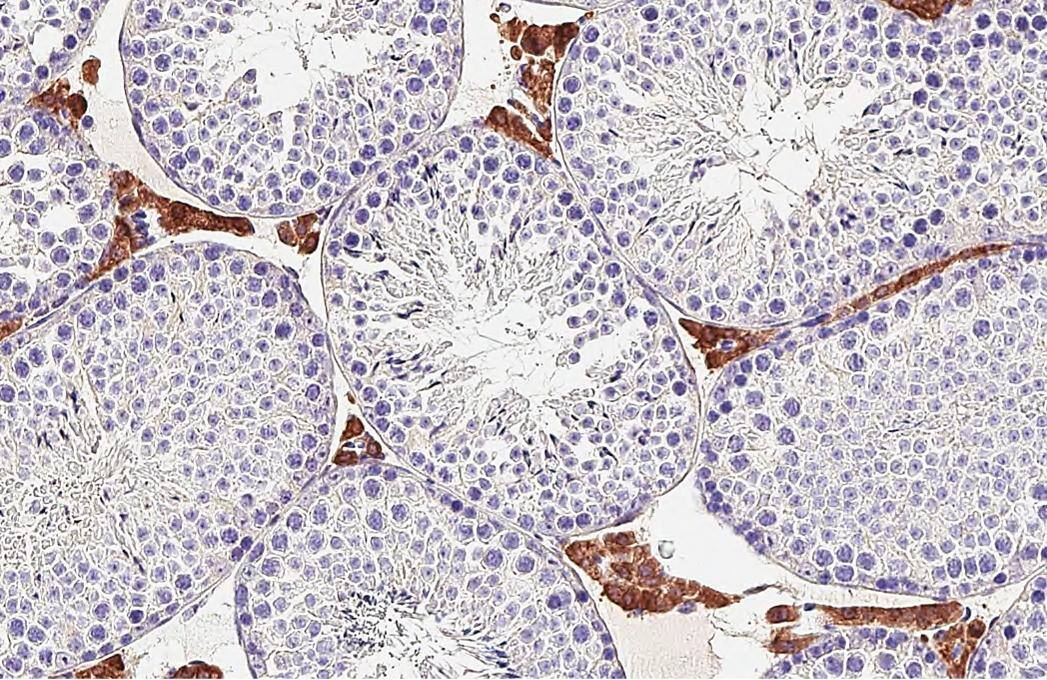DDR2 antibody [HL1107] detects DDR2 protein by immunohistochemical analysis.Sample: Paraffin-embedded mouse testis.DDR2 stained by DDR2 antibody [HL1107] (NBP3-13724) diluted at 1:16000.Antigen Retrieval: Tris-EDTA buffer, pH 9.0, 15 min 