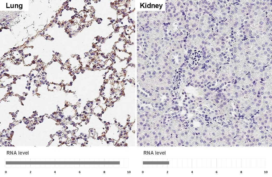 DDR2 antibody [HL1107] detects DDR2 protein by immunohistochemical analysis.Sample: Paraffin-embedded mouse tissues.DDR2 stained by DDR2 antibody [HL1107] (NBP3-13724) diluted at 1:16000.Antigen Retrieval: Tris-EDTA buffer, pH 9.0, 15 min 