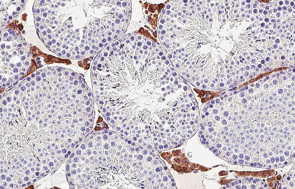  Mouse testis. DDR2 stained by DDR2 antibody [HL1107] diluted at 1:16000.Antigen Retrieval: Tris-EDTA buffer, pH 9.0, 15 min