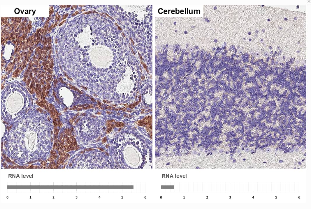 <b>Orthogonal Strategies Validation. </b> Mouse tissues.DDR2 stained by DDR2 antibody [HL1107] diluted at 1:16000.Antigen Retrieval: Tris-EDTA buffer, pH 9.0, 15 min