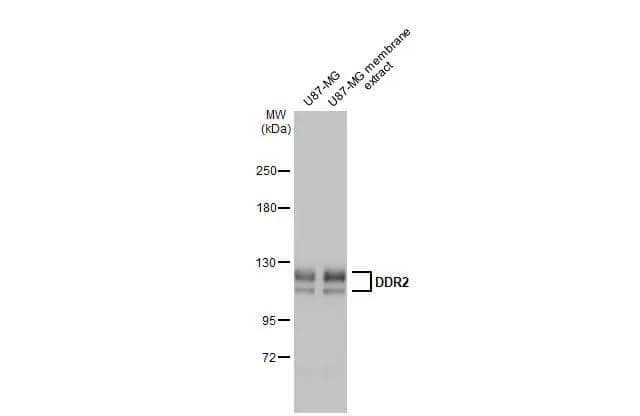 U87-MG whole cell and membrane extracts (5 ug) were separated by 5% SDS-PAGE, and the membrane was blotted with DDR2 antibody [HL1107] (NBP3-13724) diluted at 1:10000. The HRP-conjugated anti-rabbit IgG antibody  was used to detect the primary antibody. 