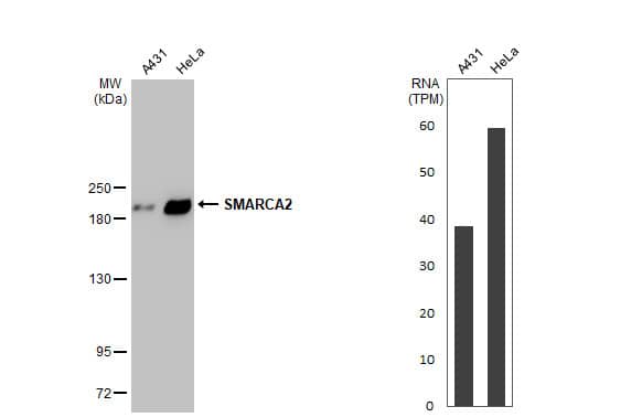 <b>Orthogonal Strategies Validation. </b>Western Blot: BRM Antibody (HL1115) [NBP3-13725] - Various whole cell extracts (30 ug) were separated by 5% SDS-PAGE, and the membrane was blotted with SMARCA2 antibody [HL1115]  diluted at 1:1000. The HRP-conjugated anti-rabbit IgG antibody  was used to detect the primary antibody. Corresponding RNA expression data for the same cell lines are based on Human Protein Atlas program.