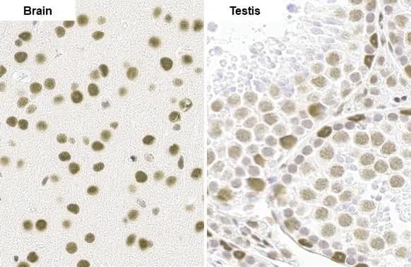 Immunohistochemistry-Paraffin: BRM Antibody (HL1115) [NBP3-13725] - BRM antibody [HL1115] detects BRM protein by immunohistochemical analysis.Sample: Paraffin-embedded mouse tissue.BRM stained by BRM antibody [HL1115] (NBP3-13725) diluted at 1:100.Antigen Retrieval: Citrate buffer, pH 6.0, 15 min