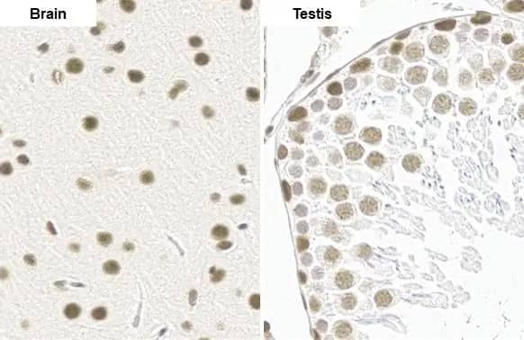 Immunohistochemistry-Paraffin: BRM Antibody (HL1115) [NBP3-13725] - BRM antibody [HL1115] detects BRM protein by immunohistochemical analysis.Sample: Paraffin-embedded rat tissue.BRM stained by BRM antibody [HL1115] (NBP3-13725) diluted at 1:100.Antigen Retrieval: Citrate buffer, pH 6.0, 15 min