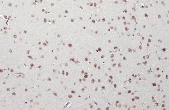 Immunohistochemistry-Paraffin BRM Antibody (HL1115) - Azide and BSA Free