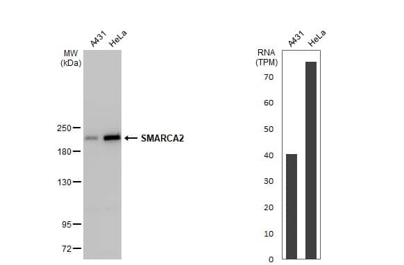 Western Blot BRM Antibody (HL1115) - Azide and BSA Free