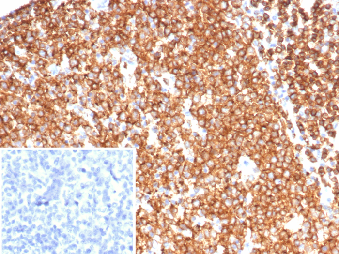 Formalin-fixed, paraffin-embedded human tonsil stained with CD45RA antibody (PTPRC/7018R). Inset: PBS instead of primary antibody; secondary only negative control.