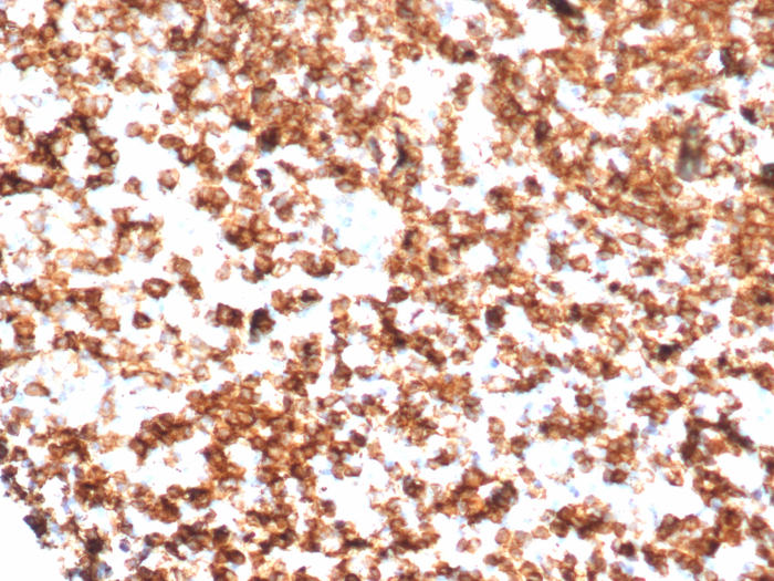 Formalin-fixed, paraffin-embedded human tonsil stained with CD45RA antibody (PTPRC/7018R). HIER: Tris/EDTA, pH9.0, 45min. Secondary: HRP-polymer, 30min. DAB, 5min.