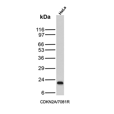 Western Blot Analysis of HeLa cell lysate using p16INK4a/CDKN2A Antibody (CDKN2A/7081R).