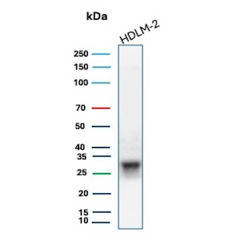 Western Blot Analysis of HDLM-2 cell lysate using HLA DQ/DR/DP Antibody (HLA-Pan/6663).