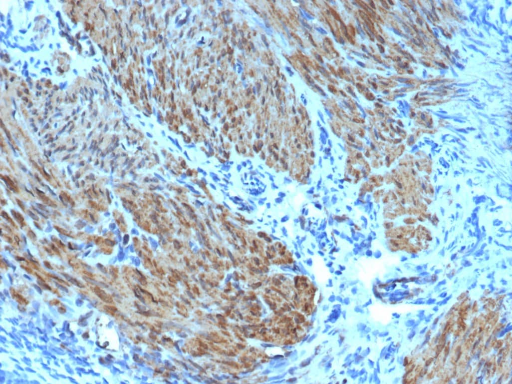 Immunohistochemistry-Paraffin Actin (Muscle Specific) Antibody (rMSA/953)