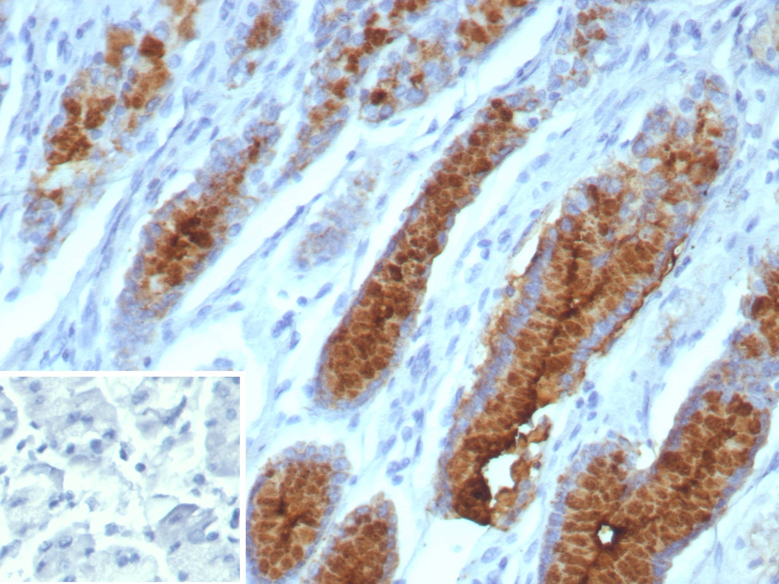 Formalin-fixed, paraffin-embedded human stomach stained with MUC5AC Antibody (MUC5AC/7066R). Inset: PBS instead of primary antibody; secondary only negative control.