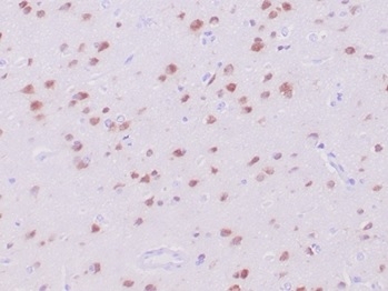 Formalin-fixed, paraffin-embedded human cerebrum stained with RBFOX3/NeuN antibody (NeuN/288R). HIER: Tris/EDTA, pH9.0, 45min. Secondary: HRP-polymer, 30min. DAB, 5min.