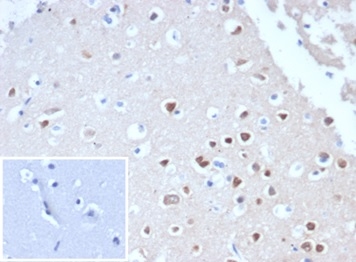 Formalin-fixed, paraffin-embedded human cerebellum stained with RBFOX3/NeuN antibody (NeuN/288R). Inset: PBS instead of primary antibody, secondary negative control.