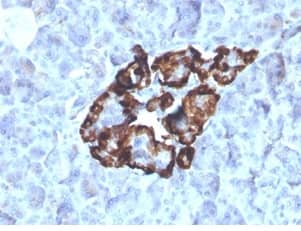 IHC analysis of formalin-fixed, paraffin-embedded human renal oncocytoma. Staining using Vitamin D BP Antibody (VDBP/4481) - Azide and BSA Free at 2ug/ml in PBS for 30min RT. HIER: Tris/EDTA, pH9.0, 45min. 2°C: HRP-polymer, 30min. DAB, 5min.