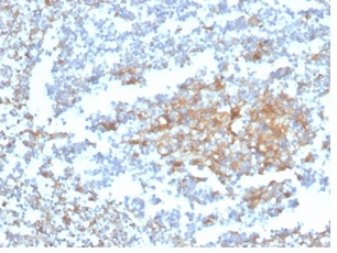 IHC analysis of formalin-fixed, paraffin-embedded human tonsil. Staining using Vitamin D BP antibody (VDBP/4482) at 2ug/ml in PBS for 30min RT. HIER: Tris/EDTA, pH9.0, 45min. Secondary: HRP-polymer, 30min. DAB, 5min.