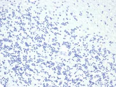 Immunohistochemistry-Paraffin: Growth Hormone Antibody (GH/4886R) - Azide and BSA Free [NBP3-14007] - IHC analysis of formalin-fixed, paraffin-embedded human brain. Negative tissue control using Growth Hormone antibody (GH/4886R) at 2ug/ml in PBS for 30min RT. HIER: Tris/EDTA, pH9.0, 45min. HRP-polymer, 30min. DAB, 5min.