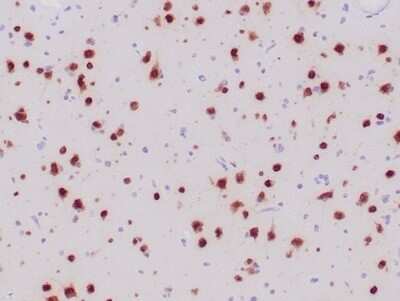 Immunohistochemistry-Paraffin: RBFOX3/NeuN Antibody (NeuN/6694R) - Azide and BSA Free [NBP3-14008] - Formalin-fixed, paraffin-embedded human ganglioma stained with RBFOX3/NeuN antibody (NeuN/6694R).