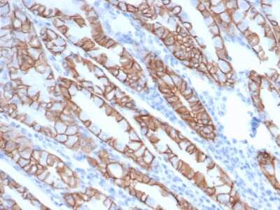 Immunohistochemistry-Paraffin: p120-catenin Antibody (rCTNND1/6903) - Azide and BSA Free [NBP3-14009] - IHC analysis of formalin-fixed, paraffin-embedded human stomach. Glandular cells stained using p120-catenin antibody (rCTNND1/6903) at 2ug/ml in PBS for 30min RT. HIER: Tris/EDTA, pH9.0, 45min. HRP-polymer, 30min. DAB, 5min.