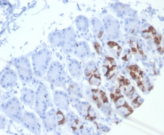 Formalin-fixed, paraffin-embedded human stomach stained with MUC6 antibody (MUC6/7069R). HIER: Tris/EDTA, pH9.0, 45min. Secondary: HRP-polymer, 30min. DAB, 5min.
