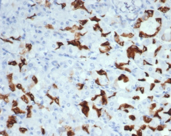 Formalin-fixed, paraffin-embedded human salivary gland stained with MUC6 antibody (MUC6/7069R). HIER: Tris/EDTA, pH9.0, 45min. Secondary: HRP-polymer, 30min. DAB, 5min.