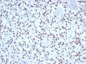 Formalin-fixed, paraffin-embedded human kidney stained with Nucleolin antibody (NCL/7338). HIER: Tris/EDTA, pH9.0, 45min. Secondary: HRP-polymer, 30min. DAB, 5min.