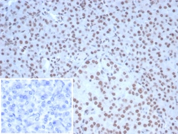 Formalin-fixed, paraffin-embedded human pancreas stained with Nucleolin antibody (NCL/7338). HIER: Tris/EDTA, pH9.0, 45min. Secondary: HRP-polymer, 30min. DAB, 5min.